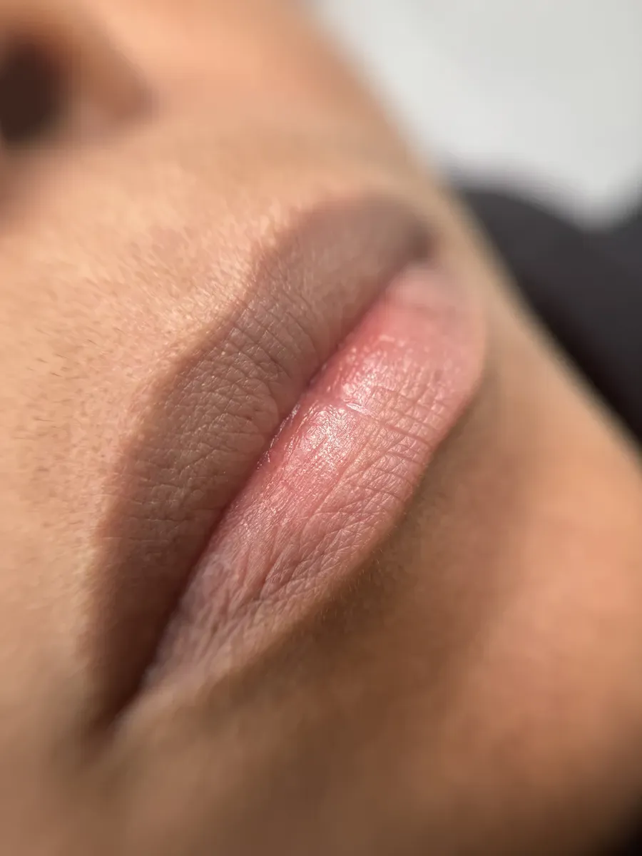 Natürlich dunkle Lippen, vor der Neutralisierung
