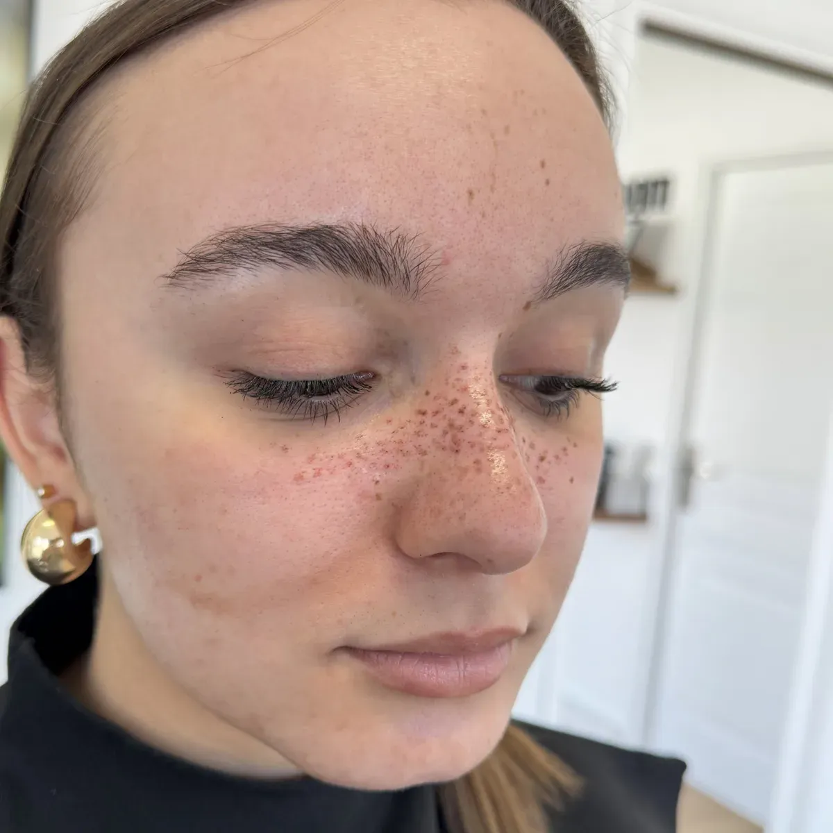A client with a size S freckle tattoo