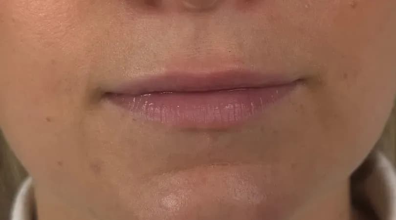 Natürliche Lippen, vor einer Full-Lips-Pigmentierung