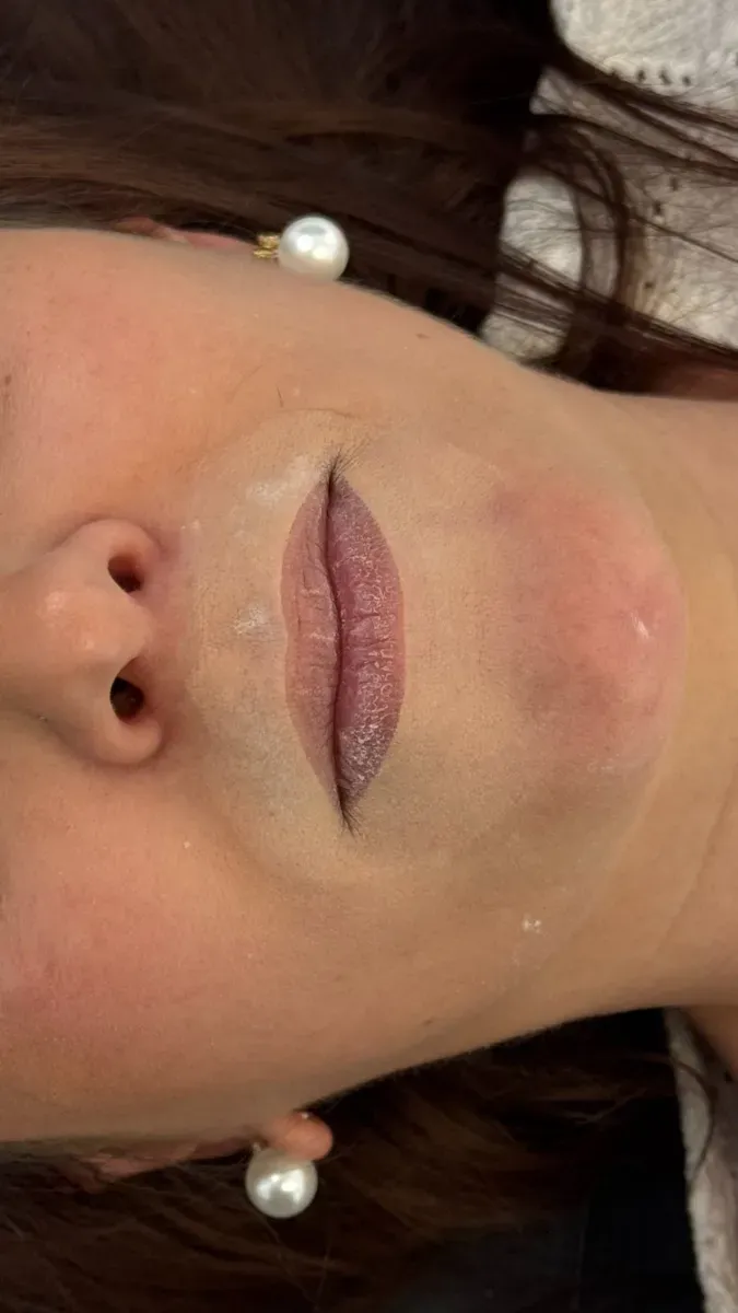 El diseño (mapping) de los labios antes de la pigmentación