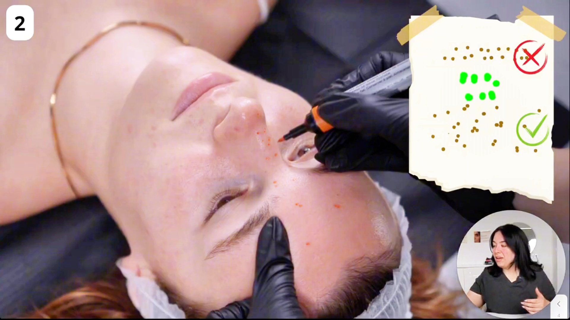 formation-faux-freckles-taches-rousseur-permanent Résultat naturel d'un tatouage de taches de rousseur (faux freckles) sur le nez et les pommettes pour un effet bonne mine.