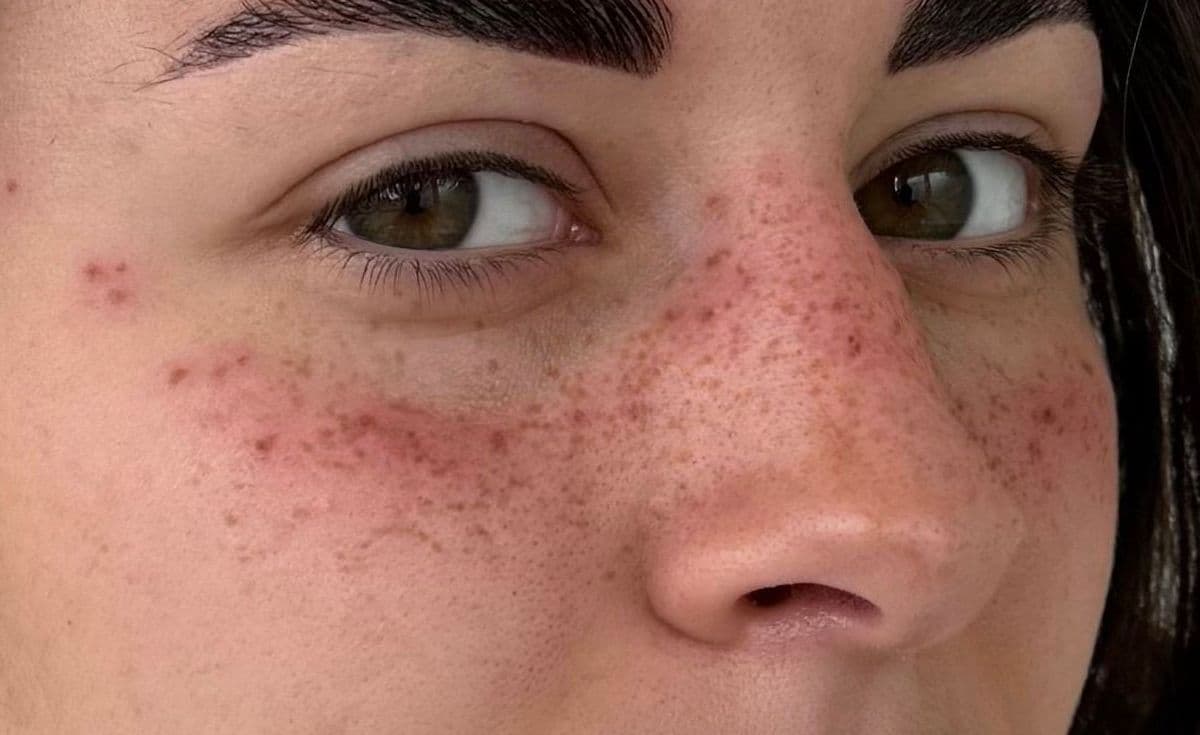 Maquillage semi-permanent des taches de rousseur concentré sur l'arête du nez et les pommettes pour un effet coup de soleil, pigments tons chauds sur peau claire.