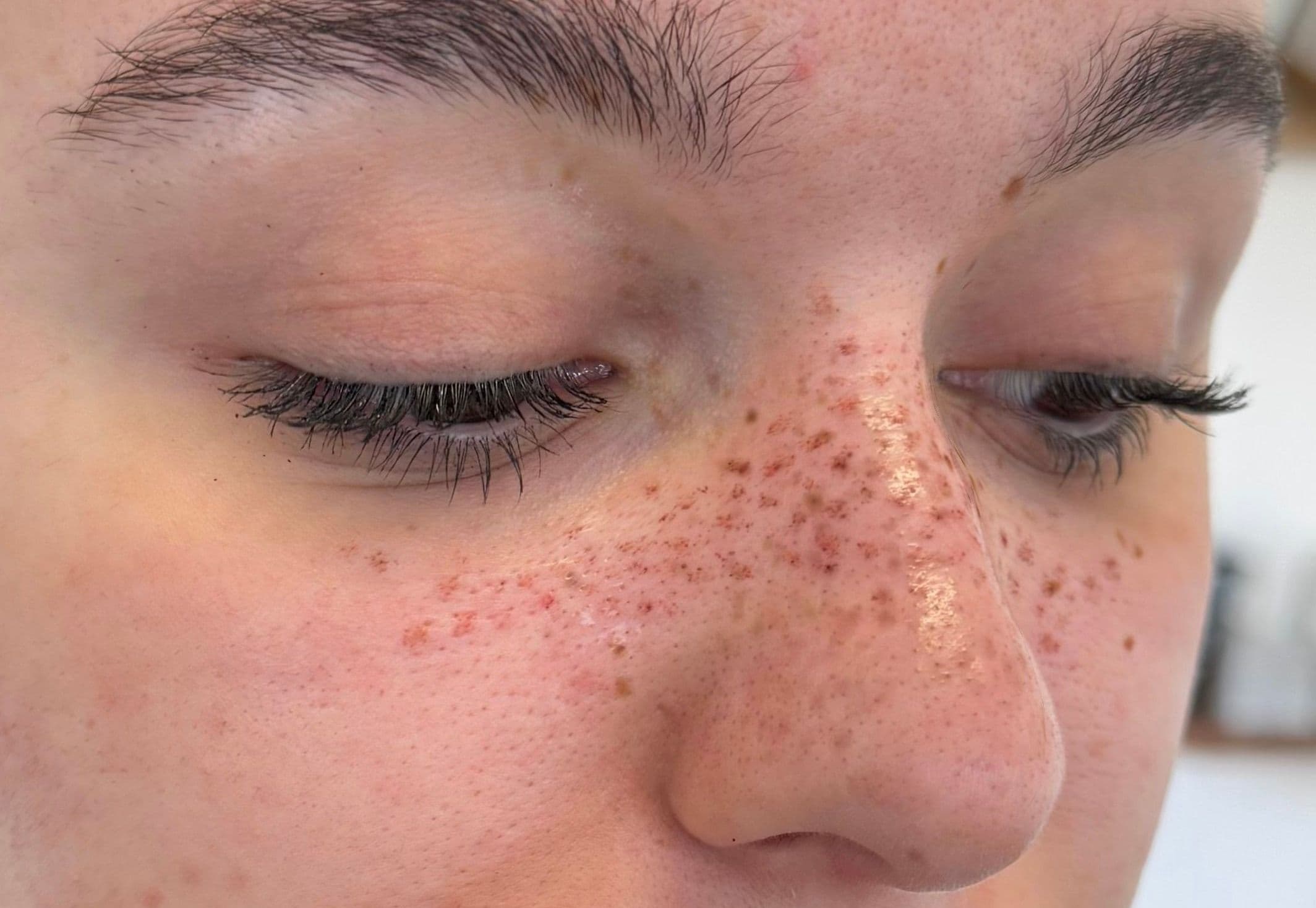 Maquillage semi-permanent de taches de rousseur sur le nez et les pommettes, pigments tons chauds sur peau blanche pour un rendu ultra-réaliste.