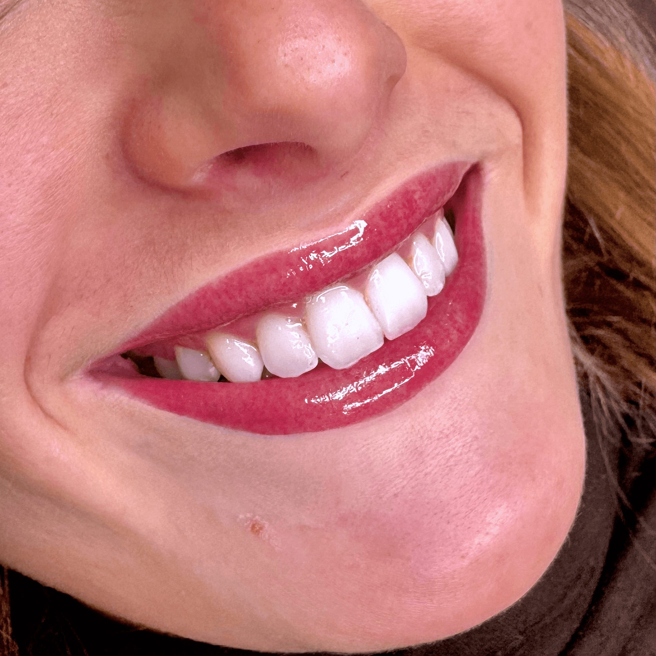 Tatouage des lèvres permanent Candy Lips affichant une couleur rouge vibrante pour un effet bouche mordue intense, une création de Habiba Med.