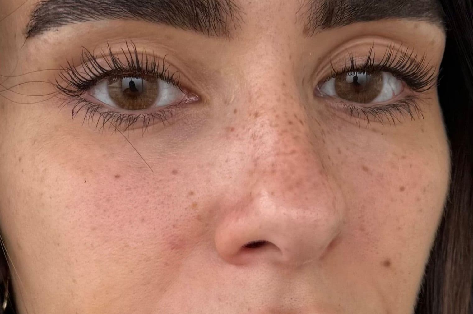 Résultat de tatouage des rousseurs semi-permanent (faux freckles) sur peau claire, taches irrégulières et naturelles signées par l'experte Habiba Med.