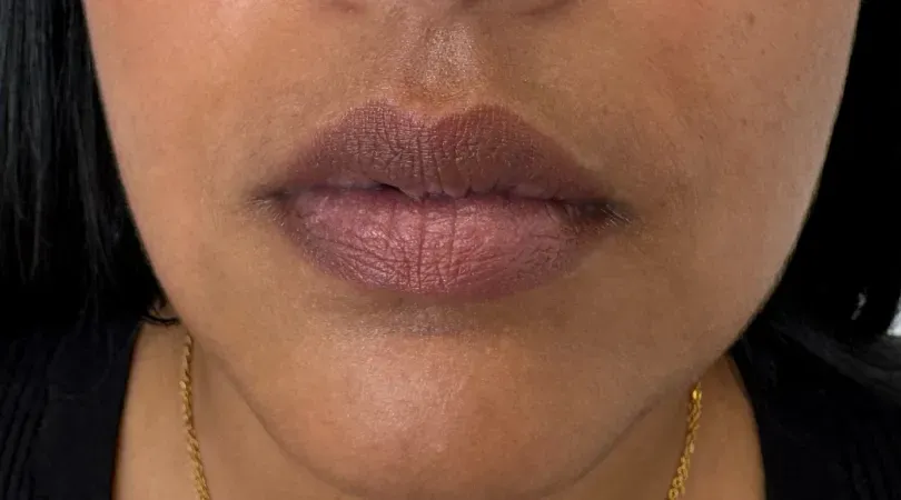 Dark lips: to lighten them, it's full lip color. If you like their color, both techniques are possible