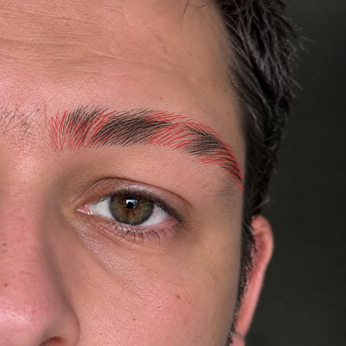 Simulation of a hair-stroke design on a man with alopecia