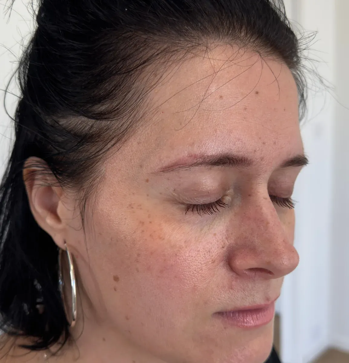 Client 1, after: her healed freckle tattoo