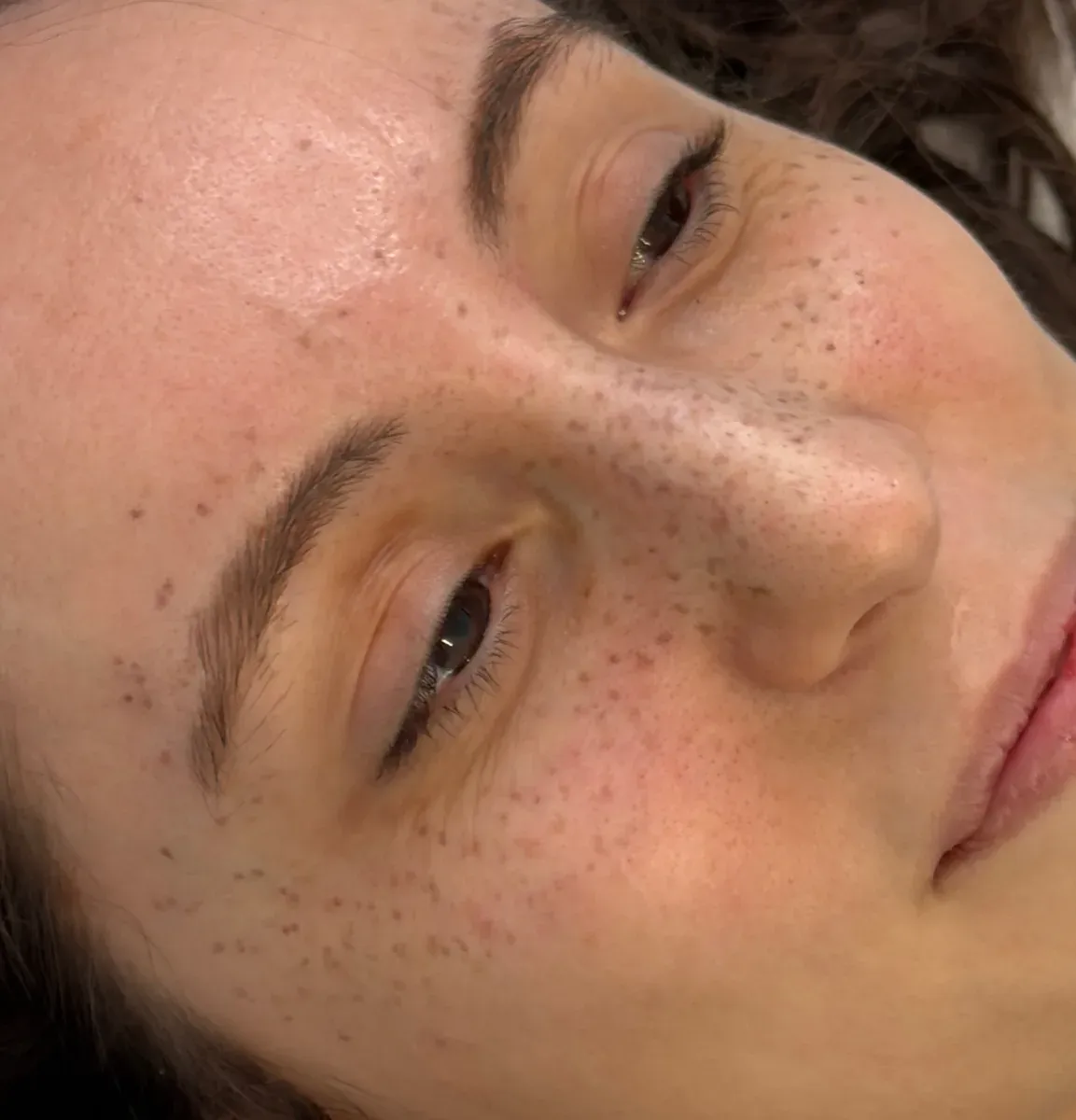 Another permanent makeup freckle tattoo result