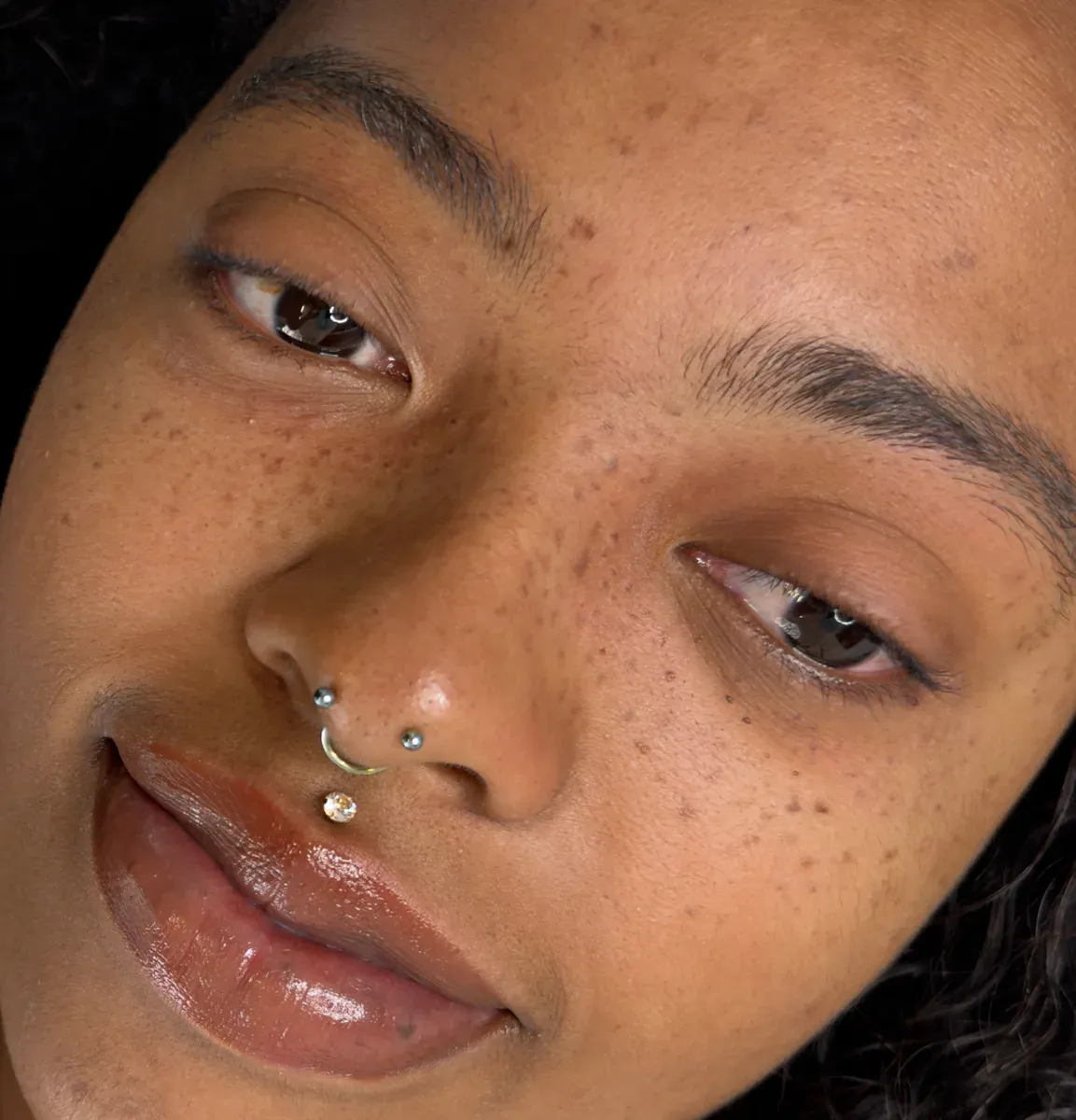 The same client, her freckles healed