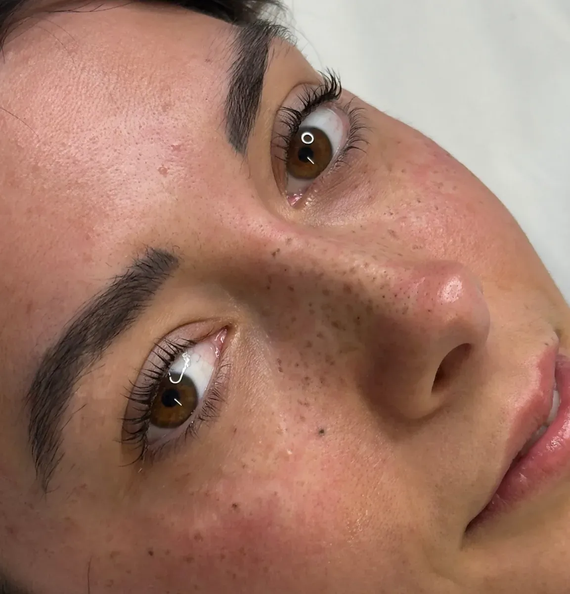 Una clienta con el efecto Hailey Bieber en pecas semipermanentes