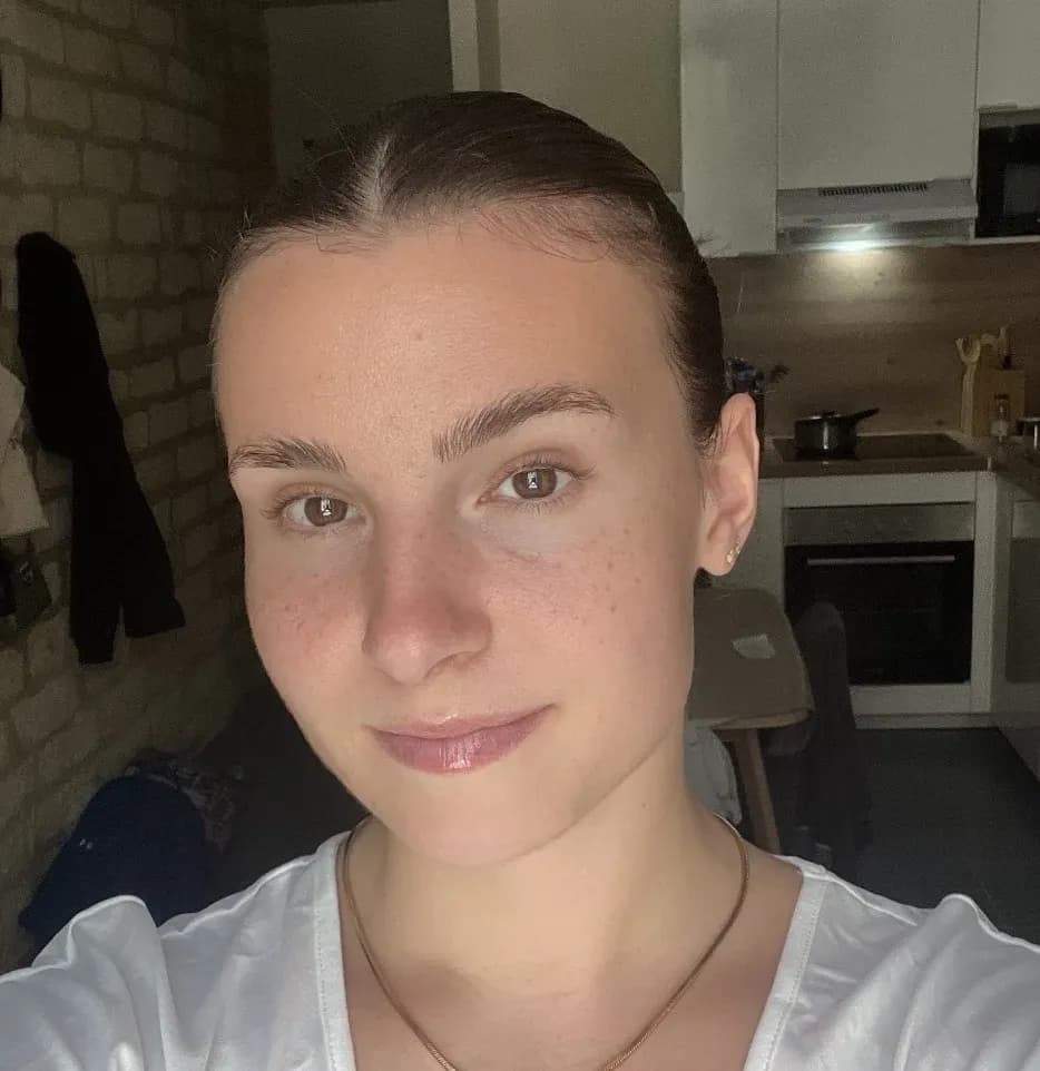 The final result: natural freckles, just the way the client wanted them