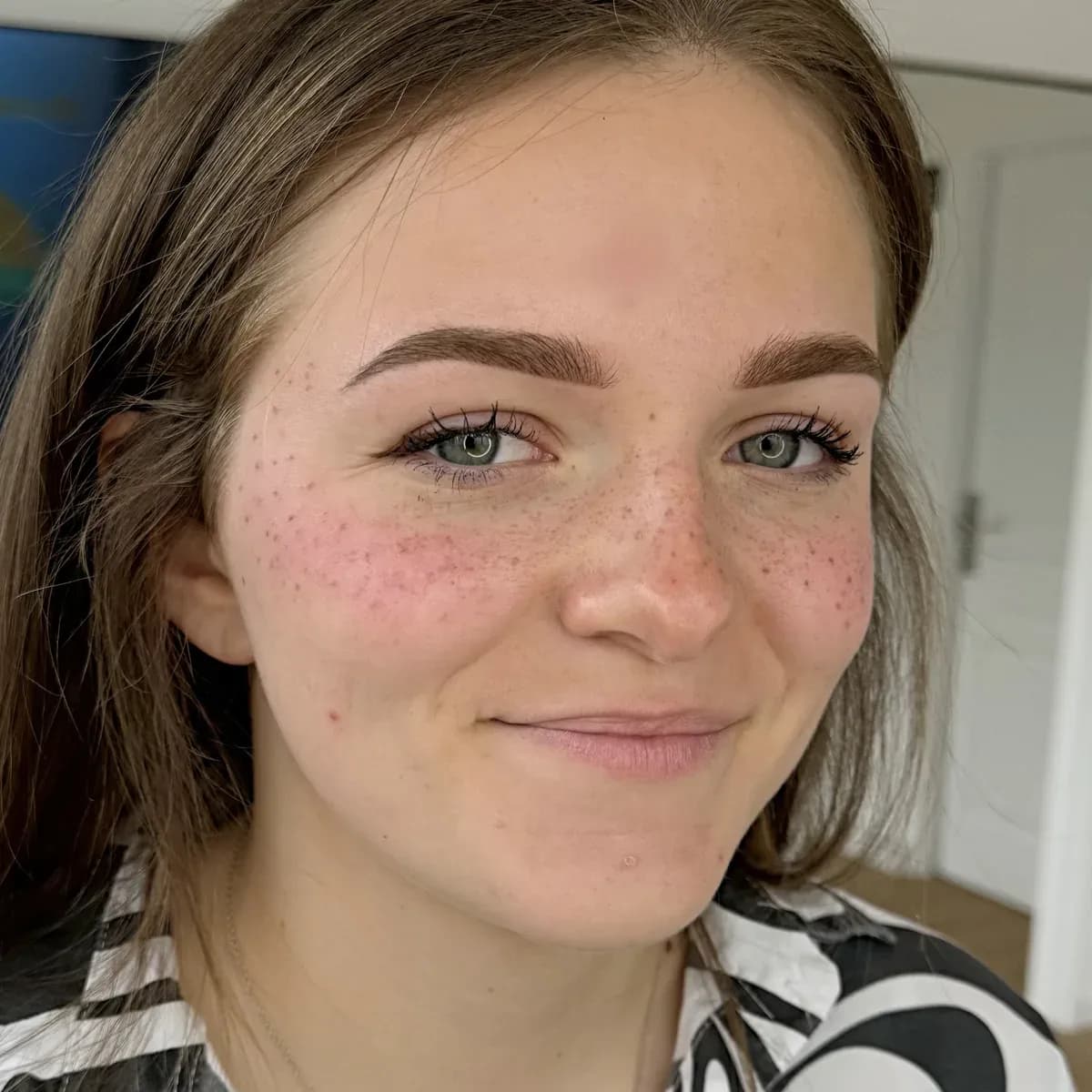Una clienta sonriente con sus pecas semipermanentes