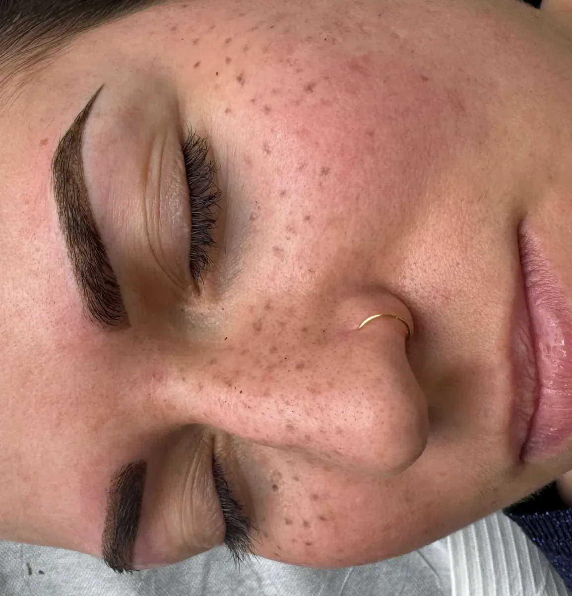 Pecas tatuadas demasiado regulares y demasiado oscuras