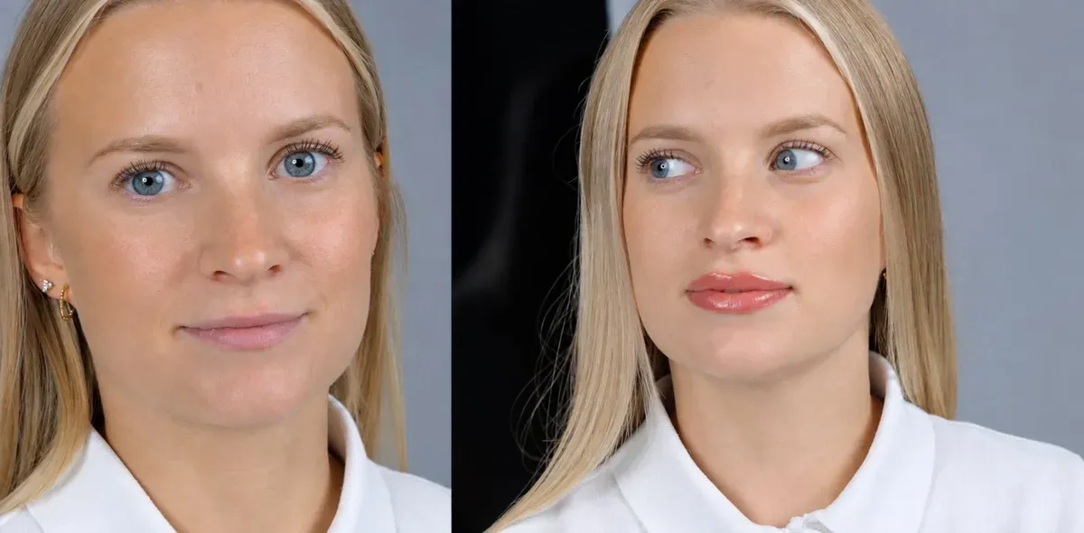 Full face before, then after a natural full lip color