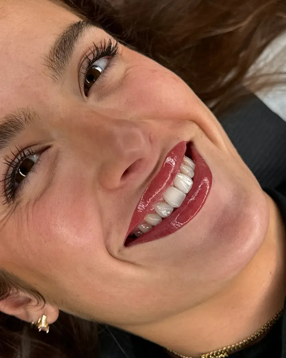 Micropigmentación de labios full lips justo después de la pigmentación