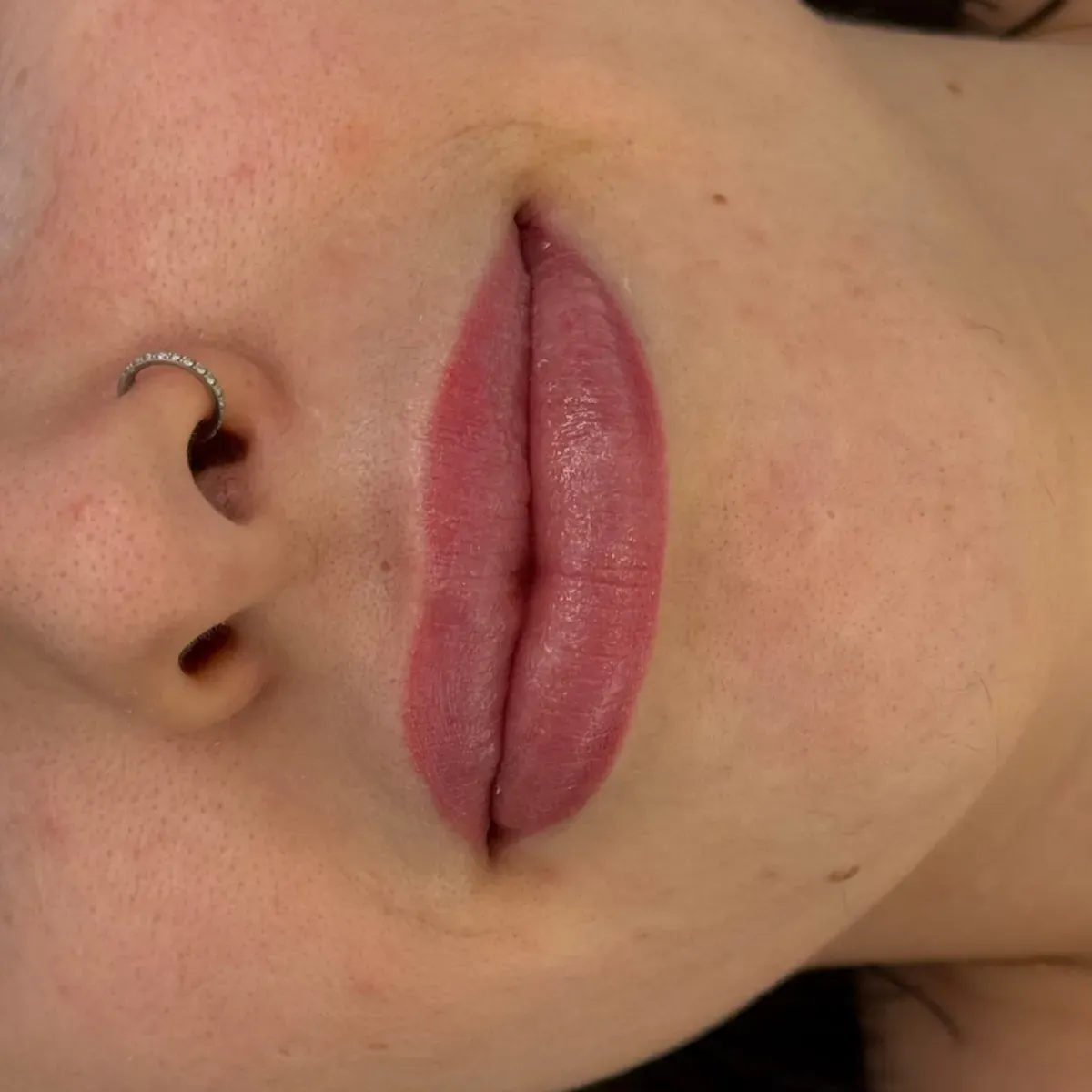 Bold full lip color, healed