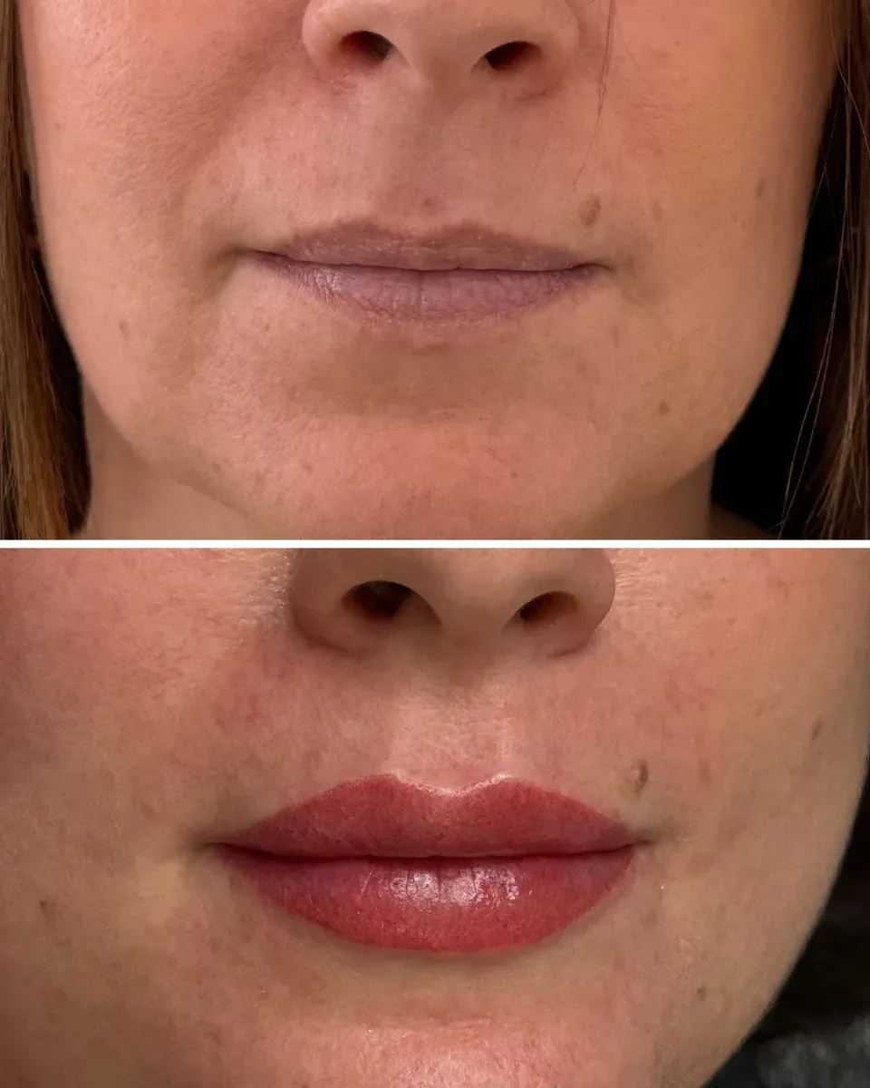 Before, then right after the session: significant swelling