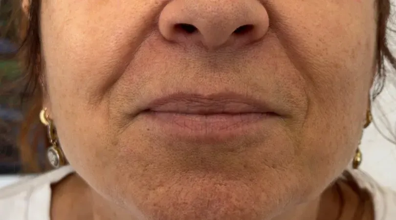 Natural mature lips, before