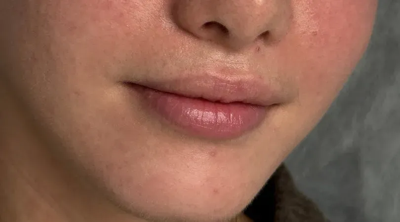 Natural lips before full lip color