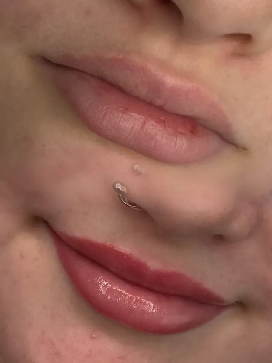 Blasse Lippe vorher, dann abgeheilte Full Lips mit natürlicher Form und Farbe