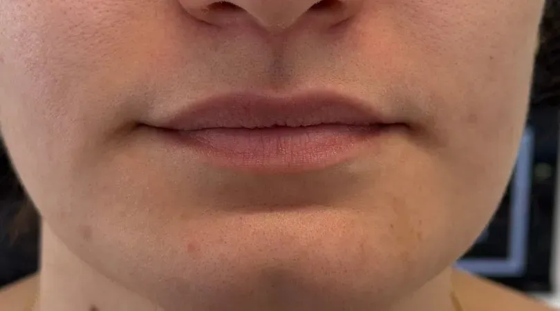 Natural lips before soft full lip color
