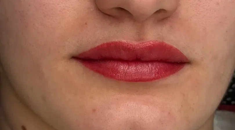 Right after soft full lip color: very slight swelling