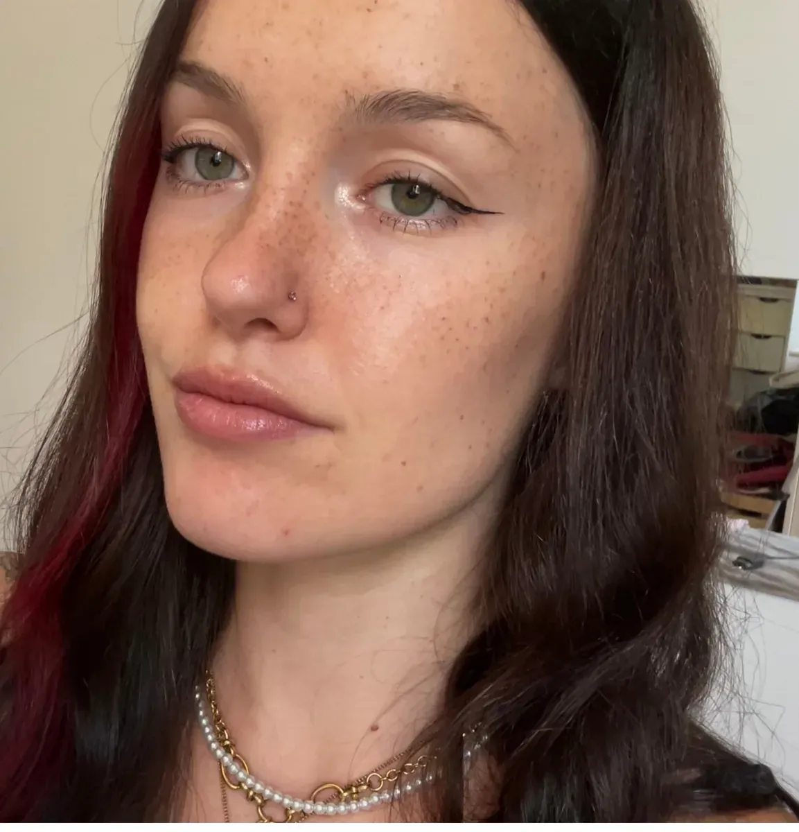 Irregular freckles in different sizes and intensities