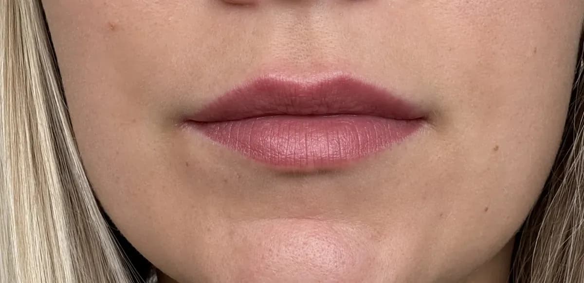 2 months later: the pigment has come back