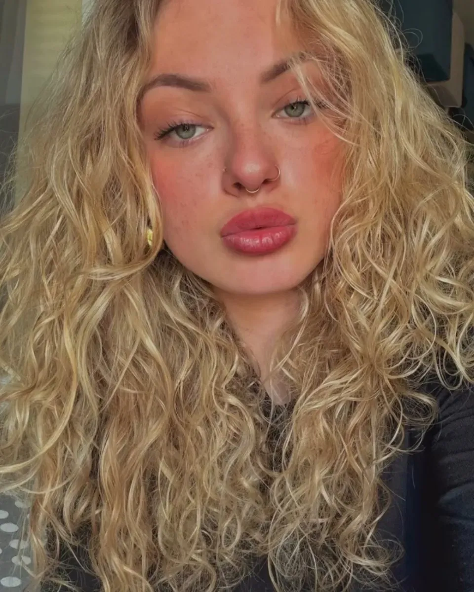 Selfie of a happy client with her healed lips