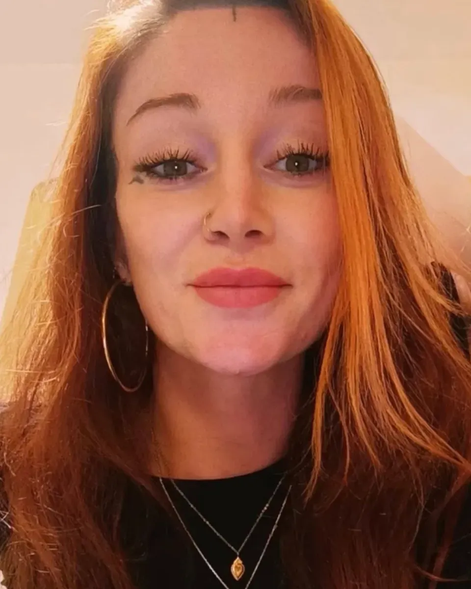 Selfie of a happy client with her healed lips