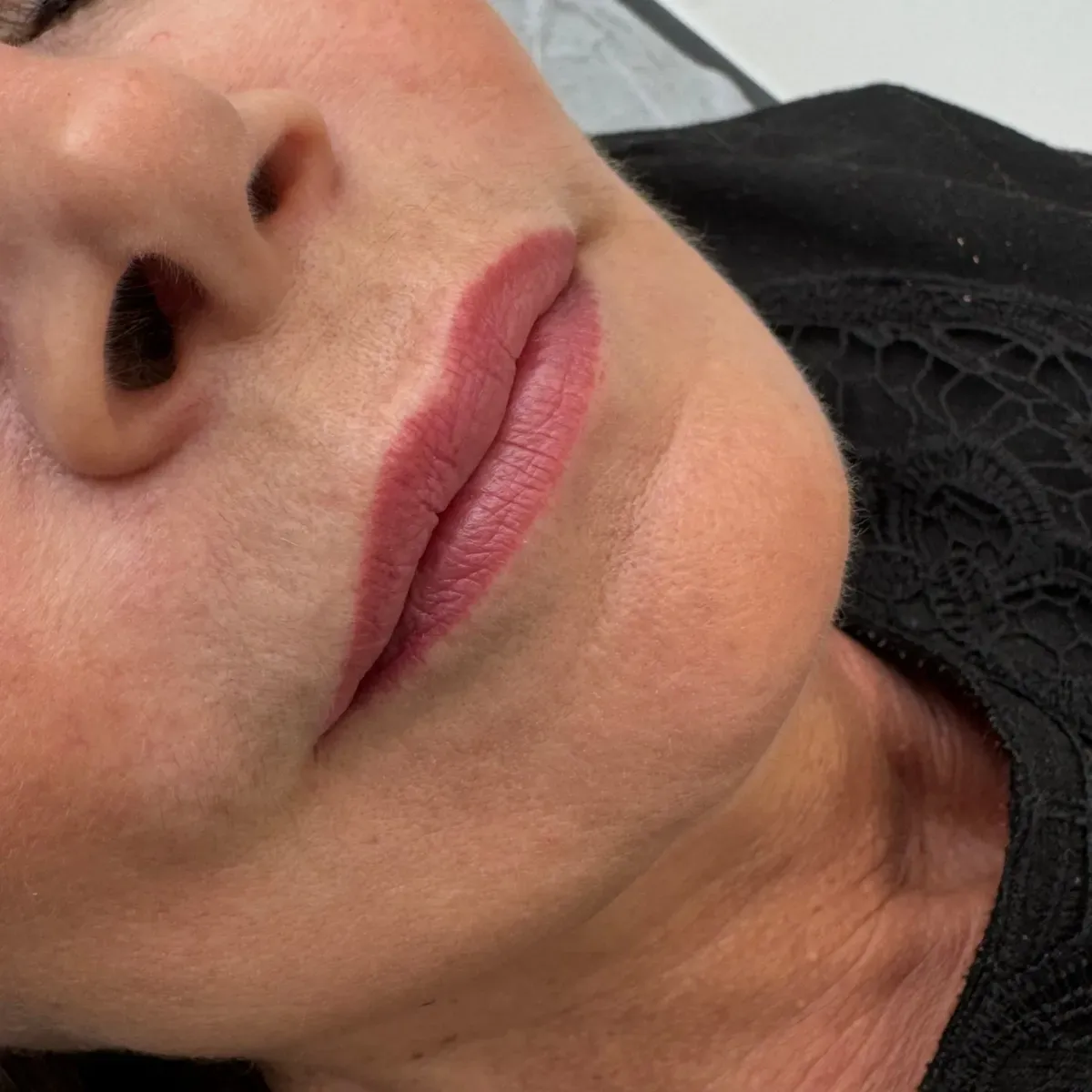 Healed mature lip, cherry red shade