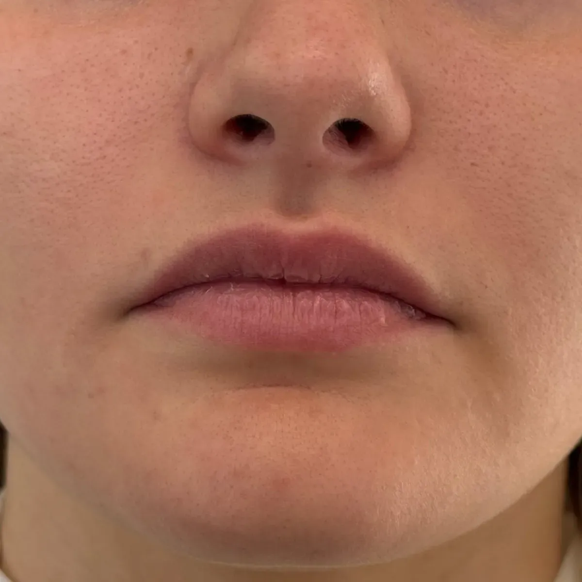 Natural light lips, before