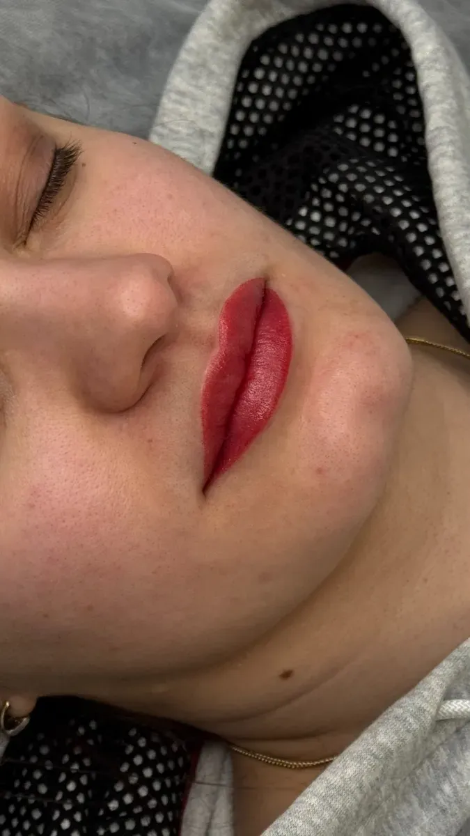 Lips right after the session: the color is brighter than once healed