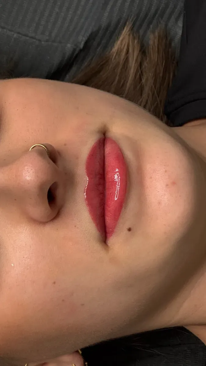Lips right after the session: the color is brighter than once healed
