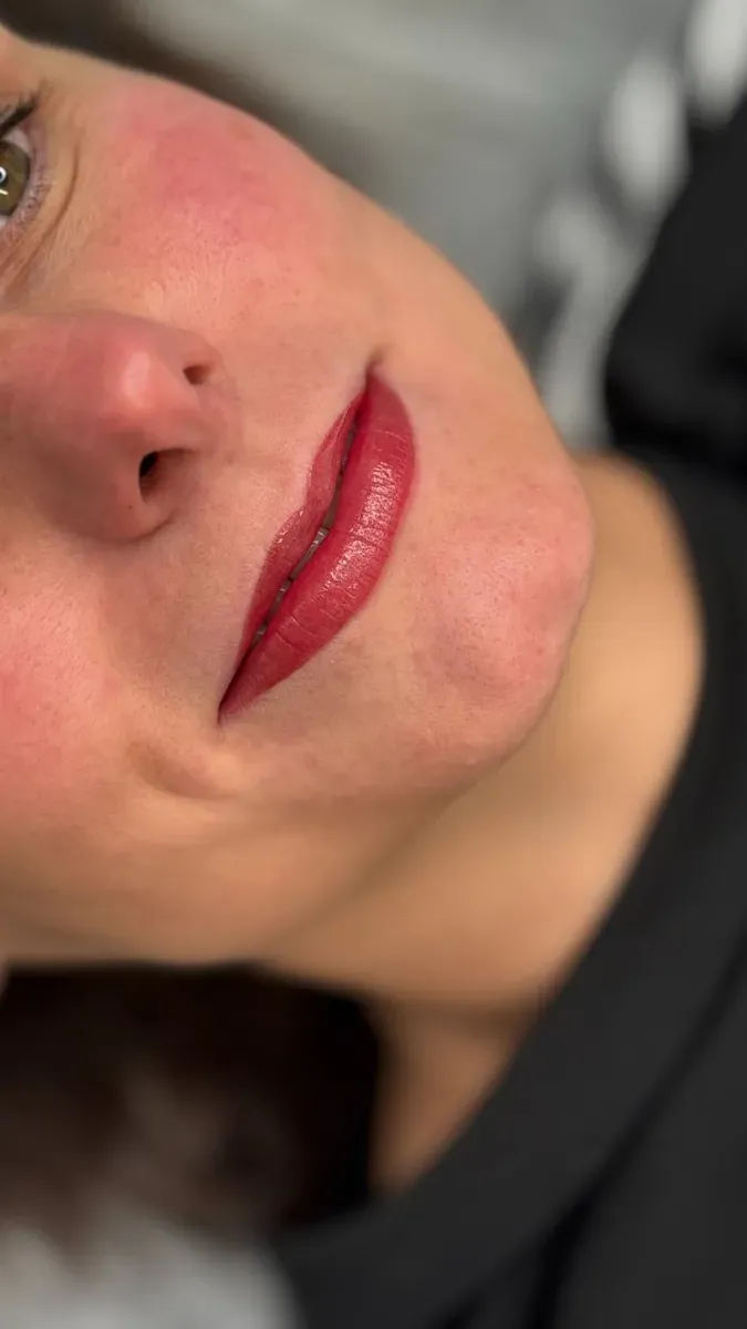 Lips right after the session: the color is brighter than once healed