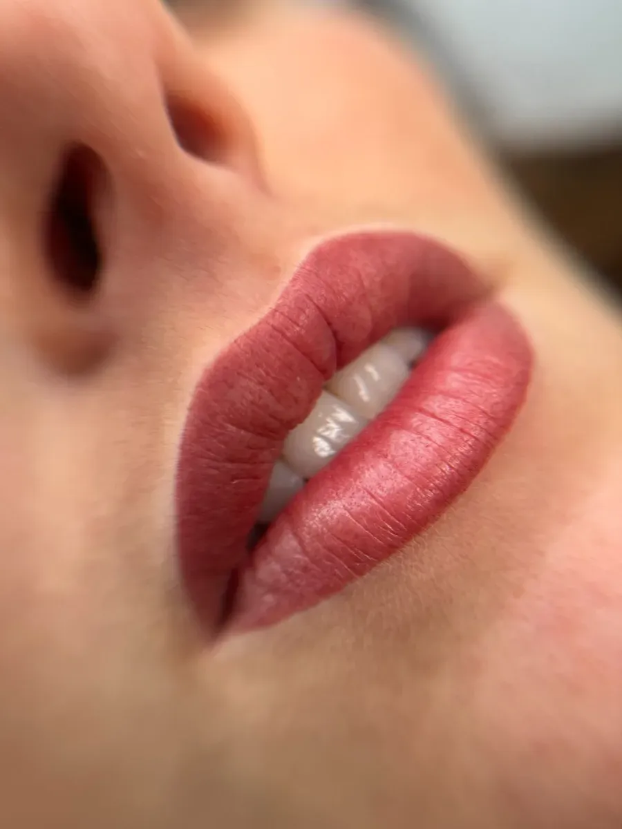 Lips right after the session: the color is brighter than once healed