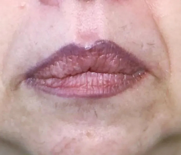 Eine alte, zu dunkle Lippenkontur