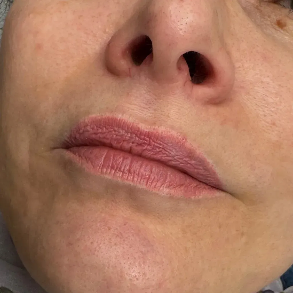 A lip liner corrected with white pigment: a correction to say no to