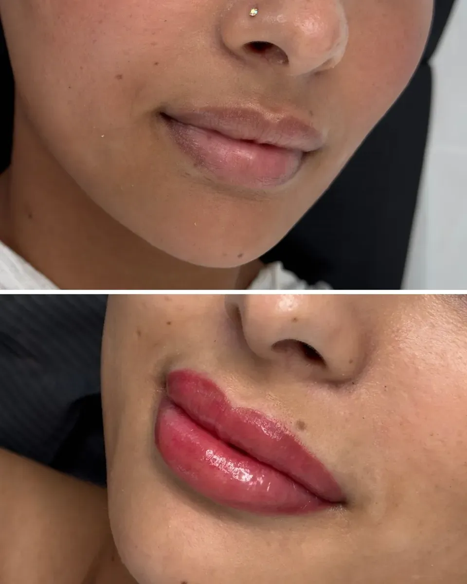 Leicht bräunliche Lippen: vorher, dann direkt nach der Neutralisierung
