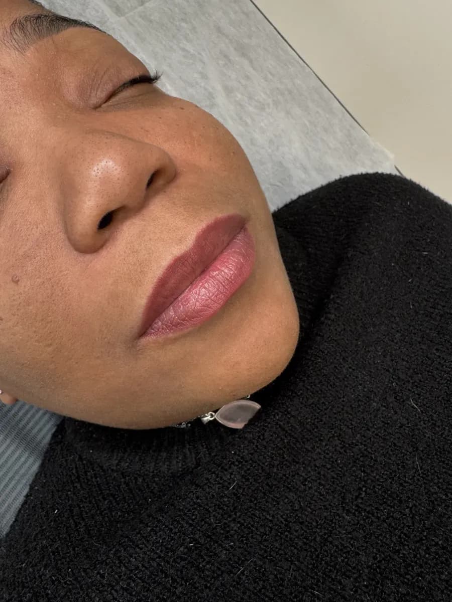 Labios oscuros neutralizados, cicatrizados tras 2 sesiones