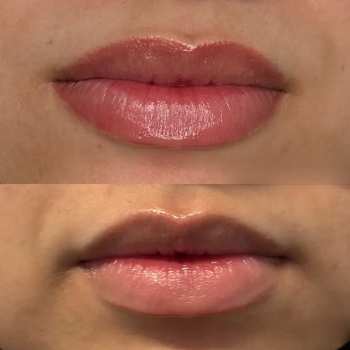Leicht dunkle Lippen einer Frau: vorher, dann nach der Neutralisierung. Dieser Grundton in Rosé und Pfirsich steht Männern extrem gut