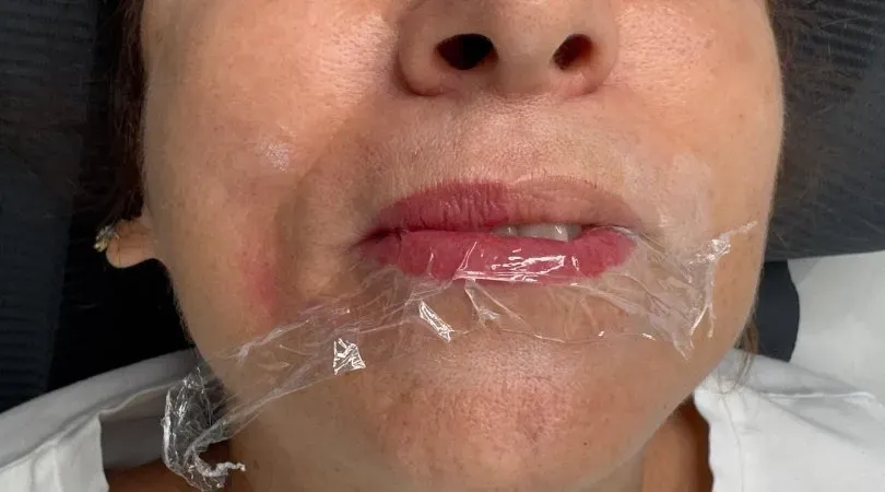 Pendant la pigmentation : pas de douleur, pas de sang