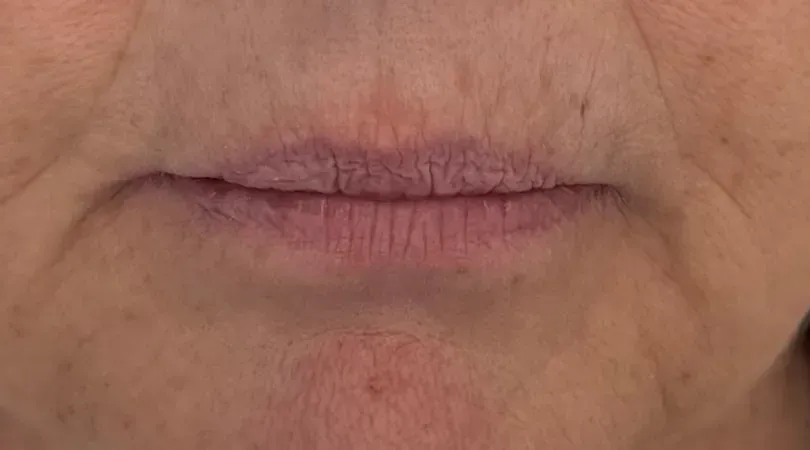 Mature, very wrinkled lips: full lip color works better, ombré isn't recommended