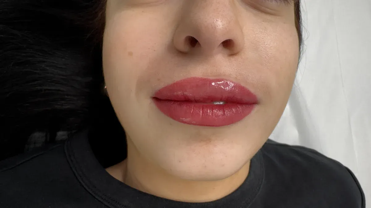 Des lèvres gonflées juste après la pigmentation : une réaction normale, qui part dans la journée