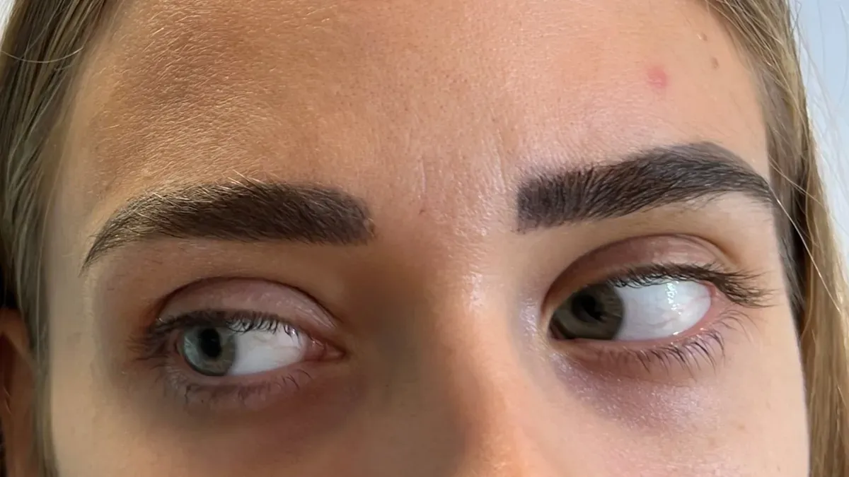 Altes Microblading, dessen Striche mit der Zeit verlaufen und verschwommen sind