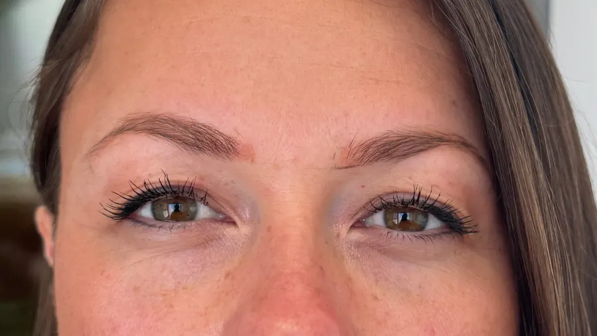 Old microblading turned orange, before the correction