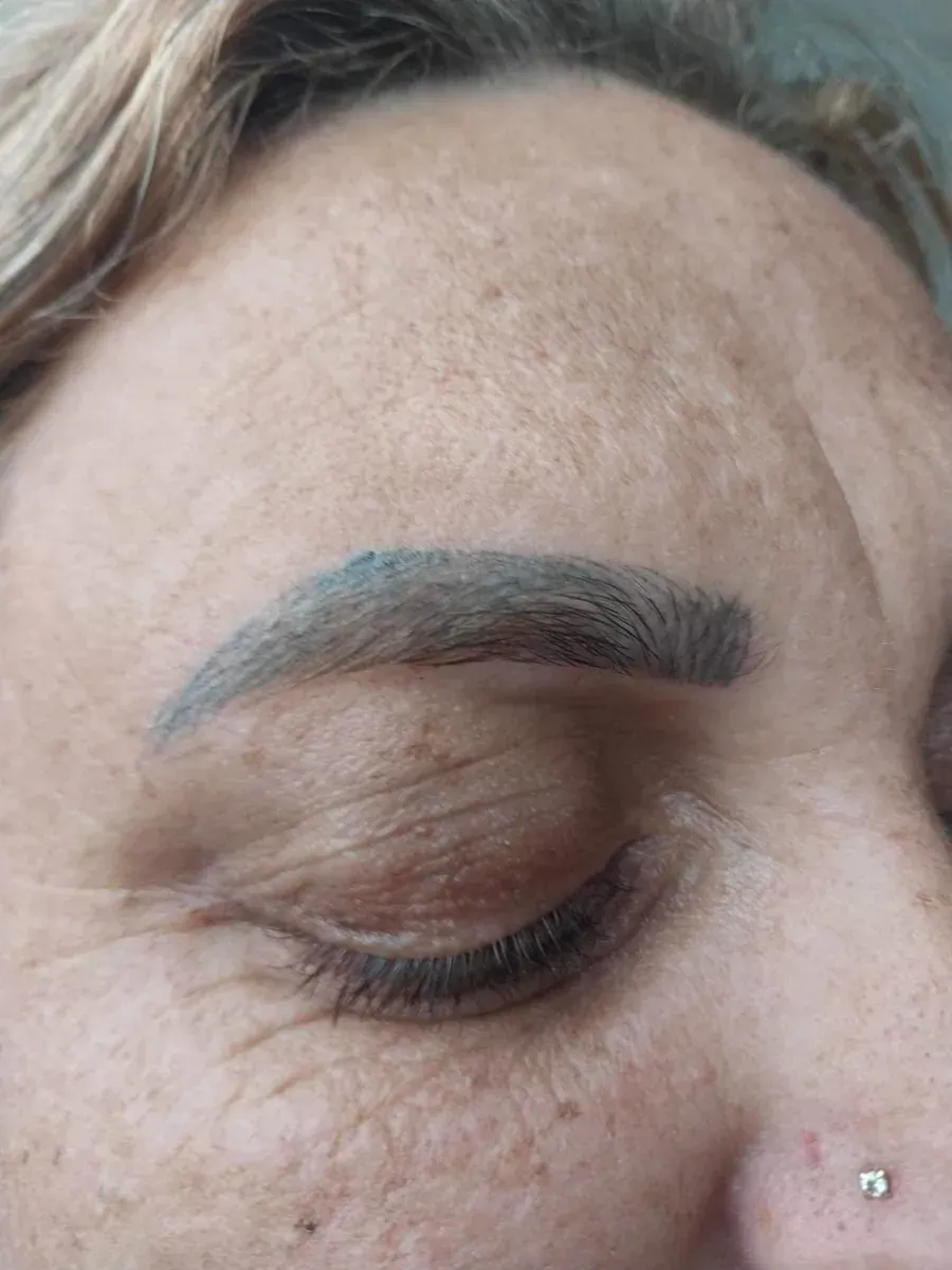 Blaues Microblading, das mit Laser entfernt werden muss