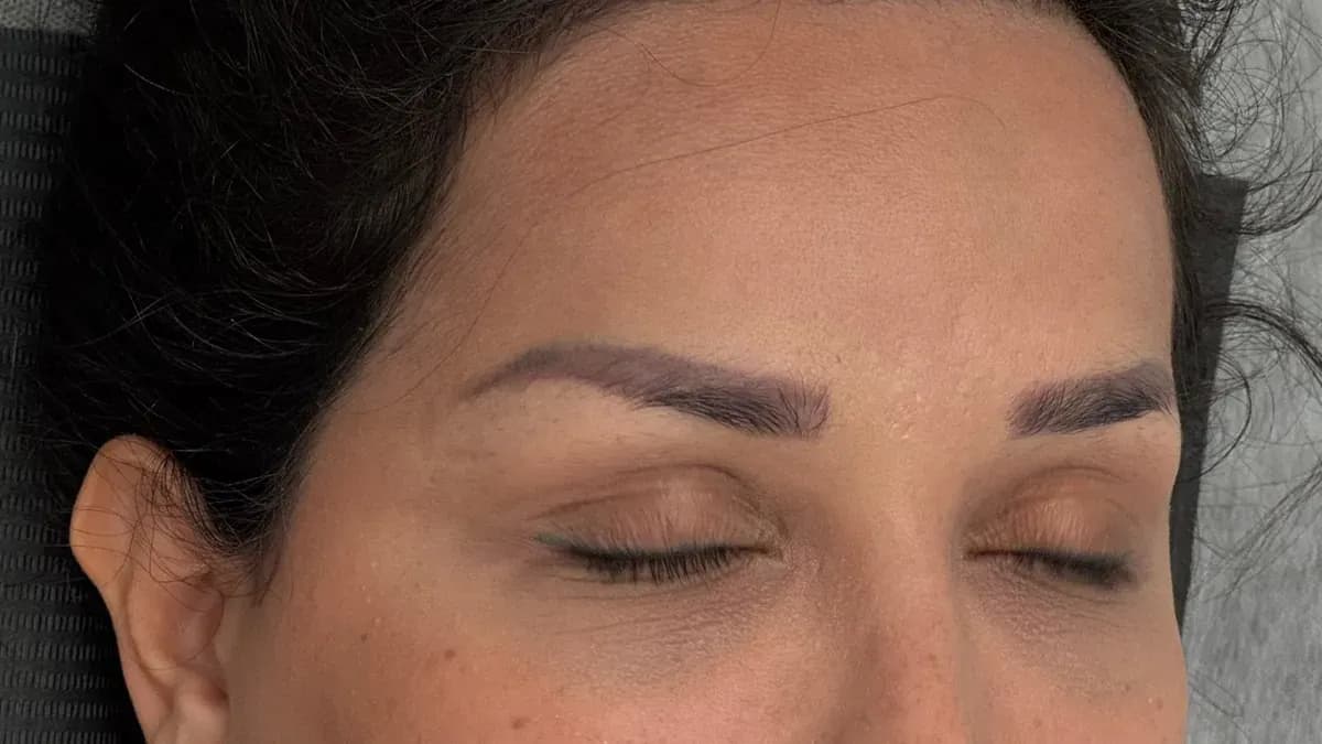 Verpfuschte Powder Brows in mehreren Farben: Laserentfernung notwendig