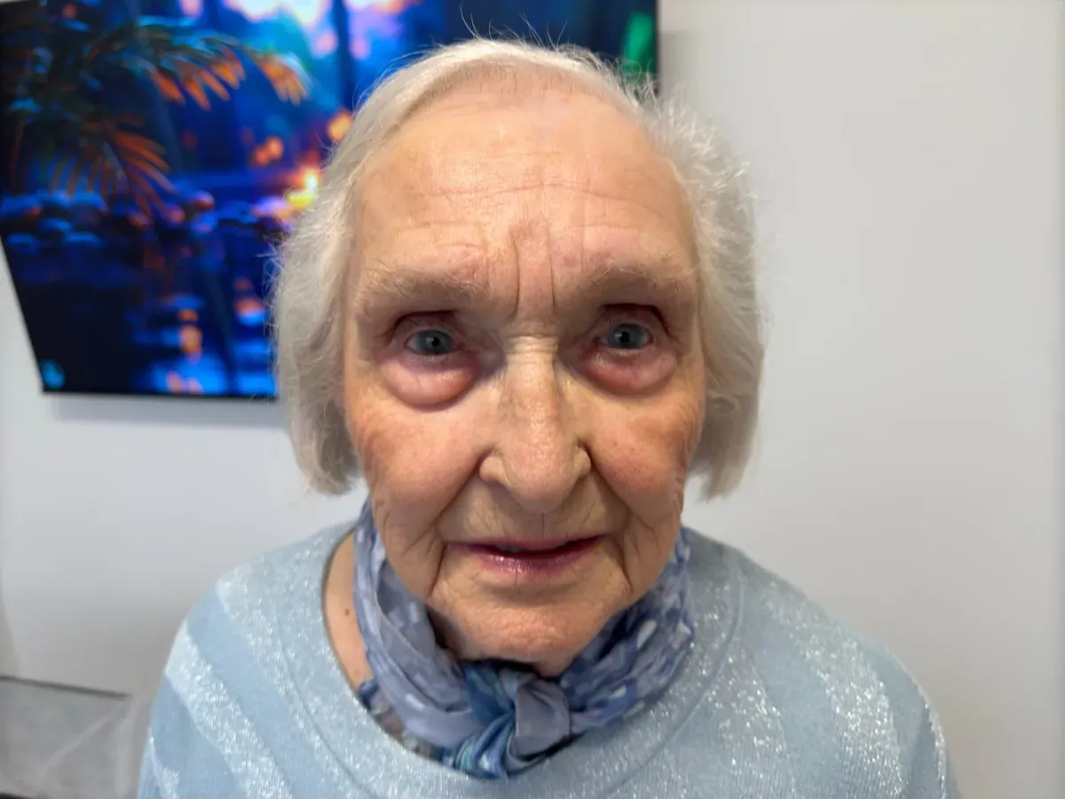 Client over 80 with white, almost nonexistent brows, before powder brows